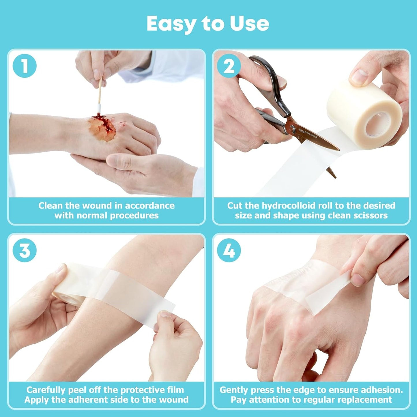 EpiPatch - 15+ Feet Hydrocolloid Roll