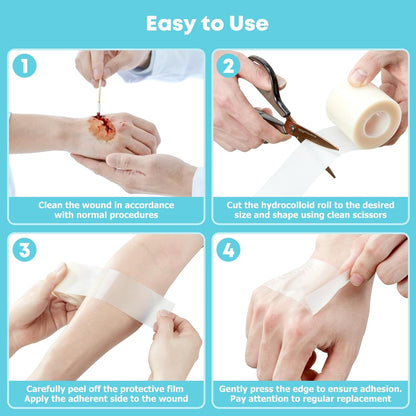 EpiPatch - 15+ Feet Hydrocolloid Roll
